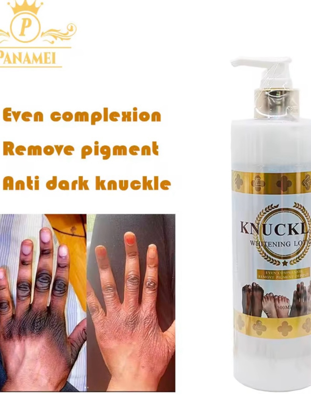 Whitening Lotion - Anti Dark Moisturizer (White)